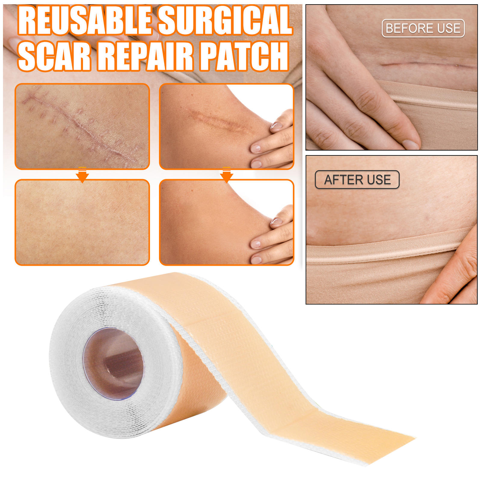 Scars Sheets Treatment Tapes Highly Comfortable Medical Easy Removal Soft Silicone Tape for C-Section Acne Wound Dressing Keloid